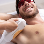 Laser Hair Removal Services Near Potomac MD